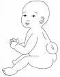 spina bifida